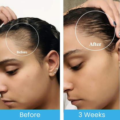 Seapuri® Scalpy Hair Serum 20ml