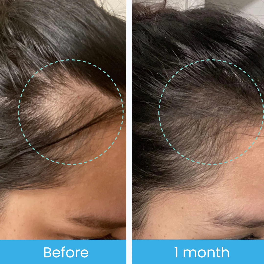 Seapuri® Scalpy Hair Serum 20ml