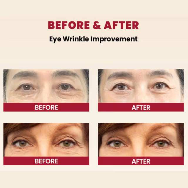 K-SECRET SEOUL 1988 Retinal Eye Cream