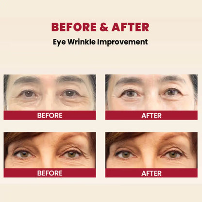 K-SECRET SEOUL 1988 Retinal Eye Cream