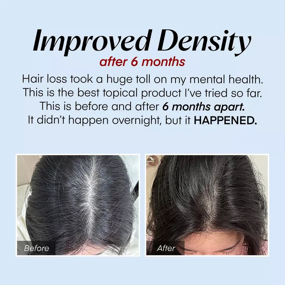 Seapuri® Scalpy Hair Serum 20ml